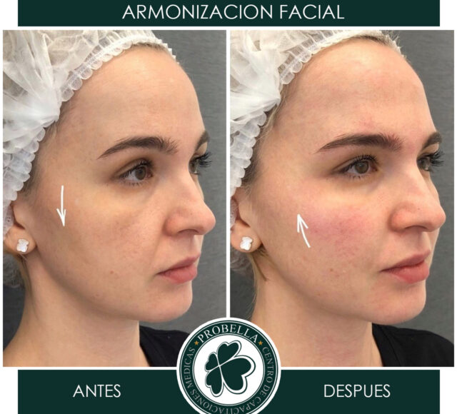 ARMONIZACION FEMENINA10