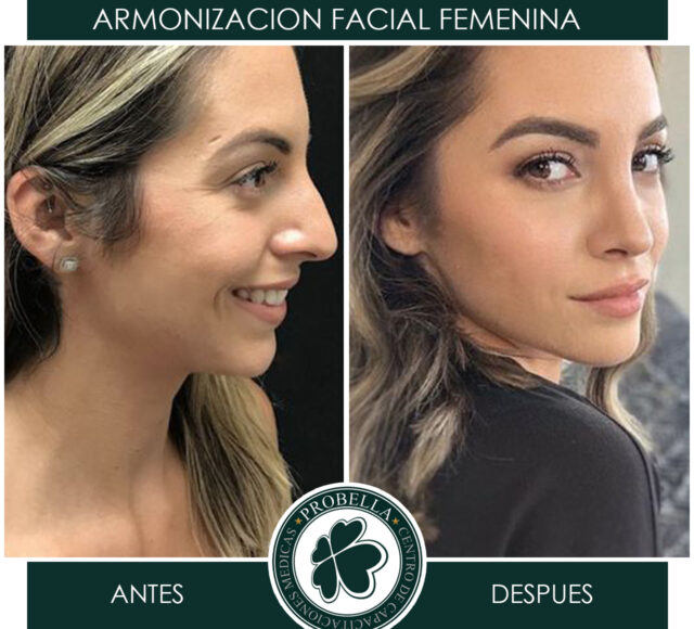 ARMONIZACION FEMENINA4