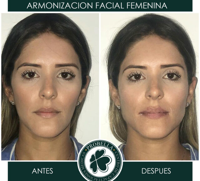 ARMONIZACION FEMENINA6