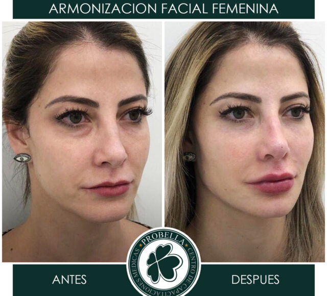 ARMONIZACION FEMENINA7