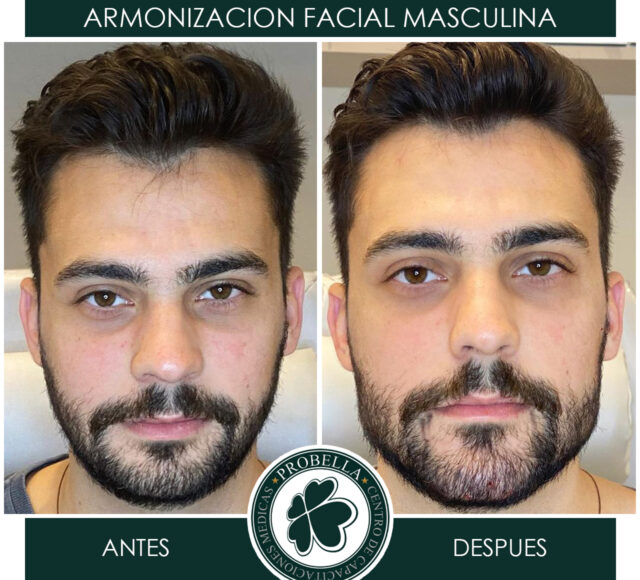 ARMONIZACION MASCULINA 12