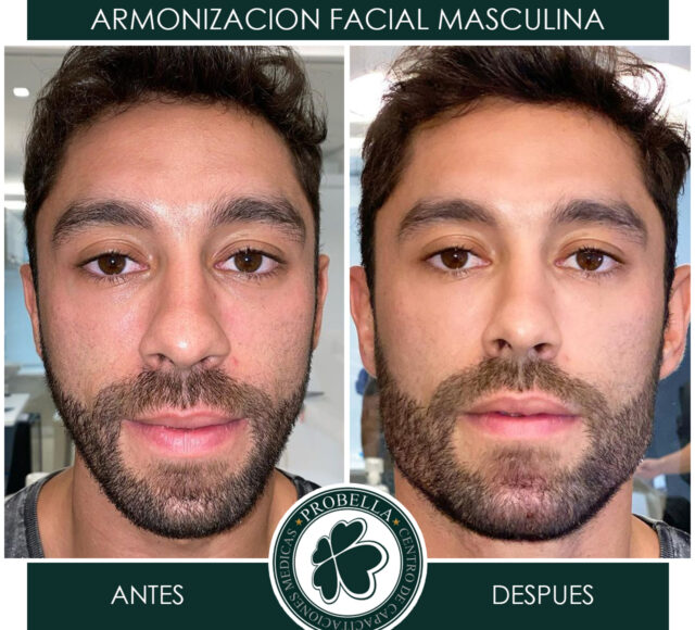 ARMONIZACION MASCULINA 13