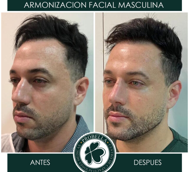 ARMONIZACION MASCULINA 15